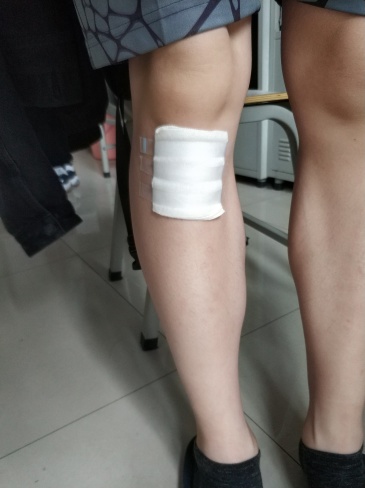 我是长在膝盖下方的大包,不疼,可以随皮肤移动.