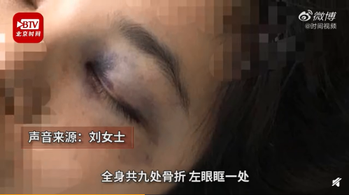检方回应女子不堪家暴跳楼！具体是怎么回应的？附事件始末详情！
