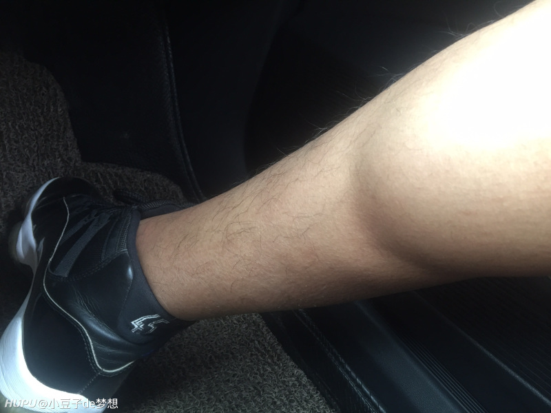 都在发跟腱,但是一直看不懂