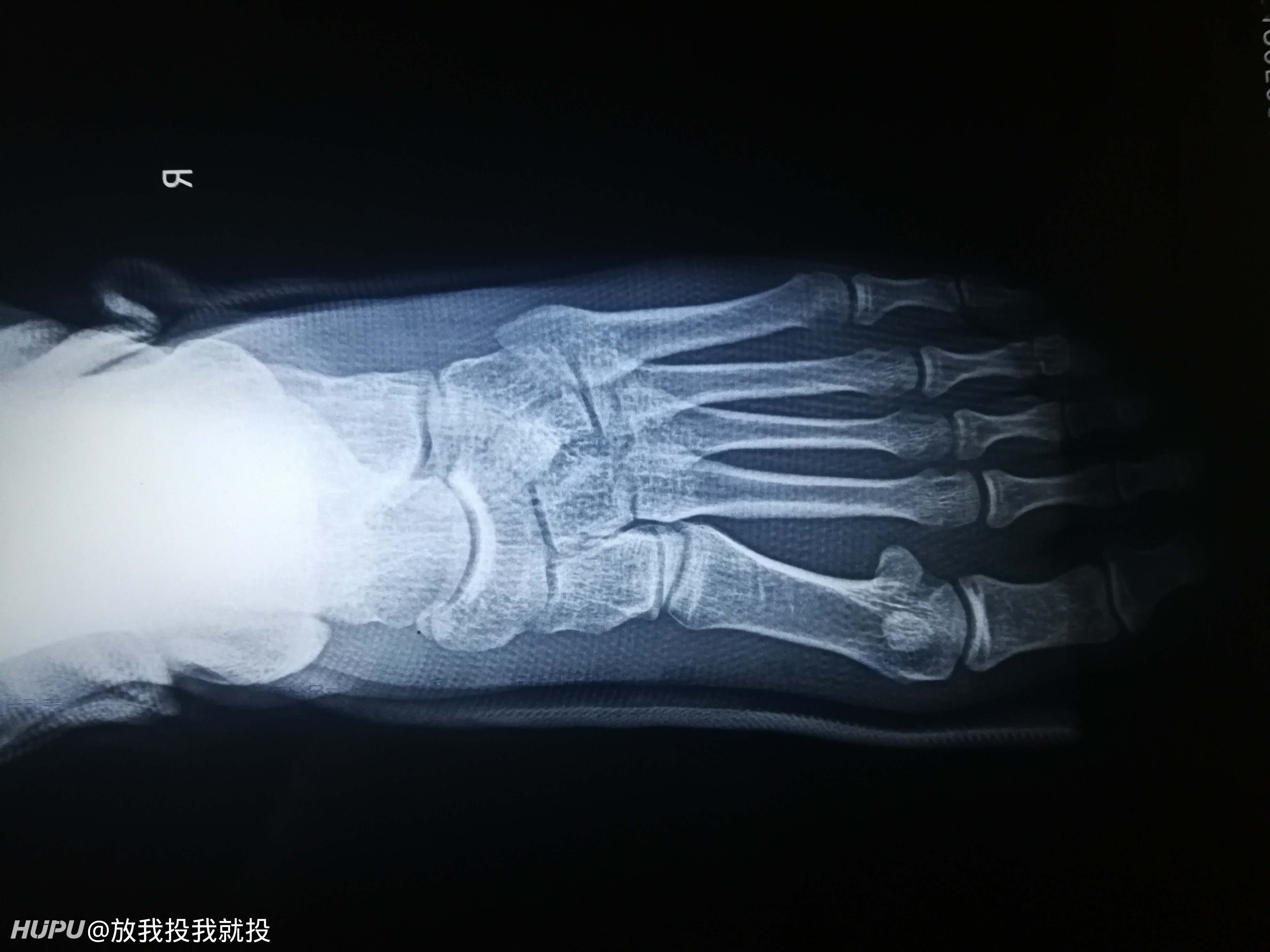 终于轮到我了 我是运动康复专家 大家有什么想问的 19年5月日虎扑存档 看帖神器 终于轮到我了 我是运动康复专家 大家有什么想问的 19年5月日虎扑存档 看帖神器