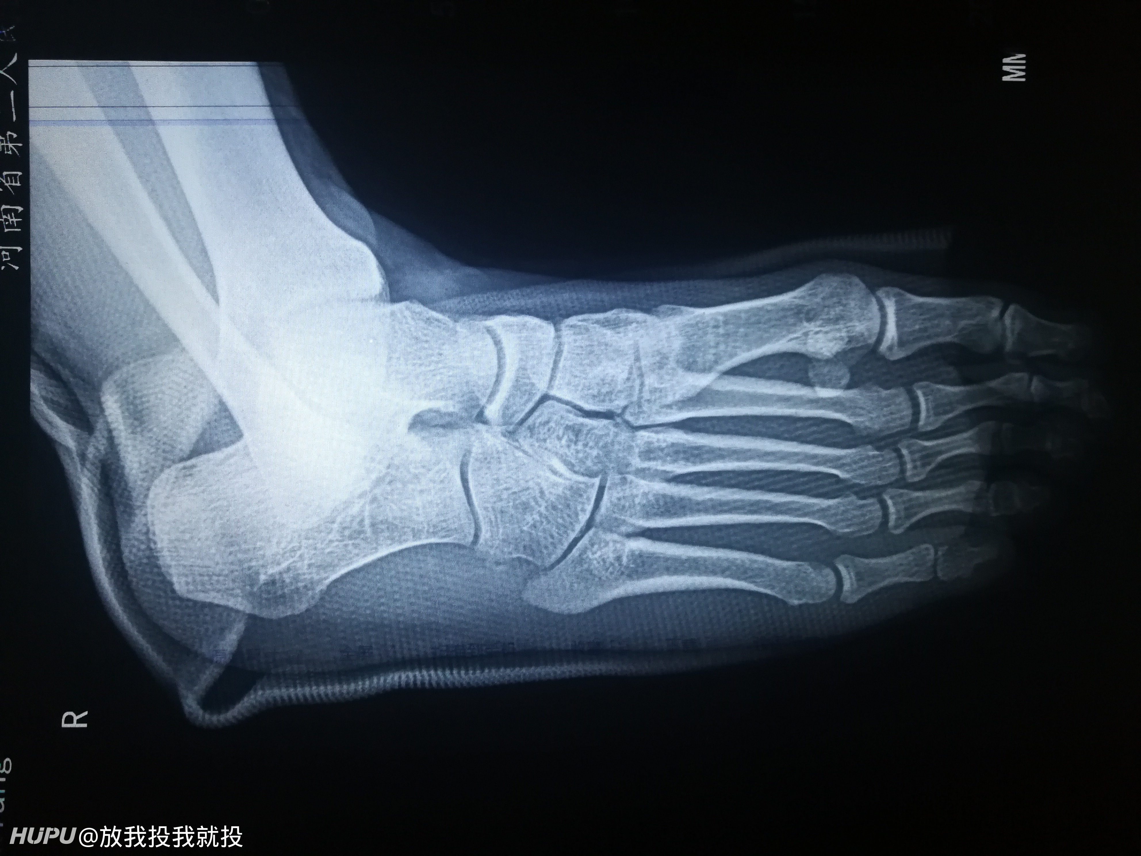 终于轮到我了 我是运动康复专家 大家有什么想问的 19年5月日虎扑存档 看帖神器 终于轮到我了 我是运动康复专家 大家有什么想问的 19年5月日虎扑存档 看帖神器