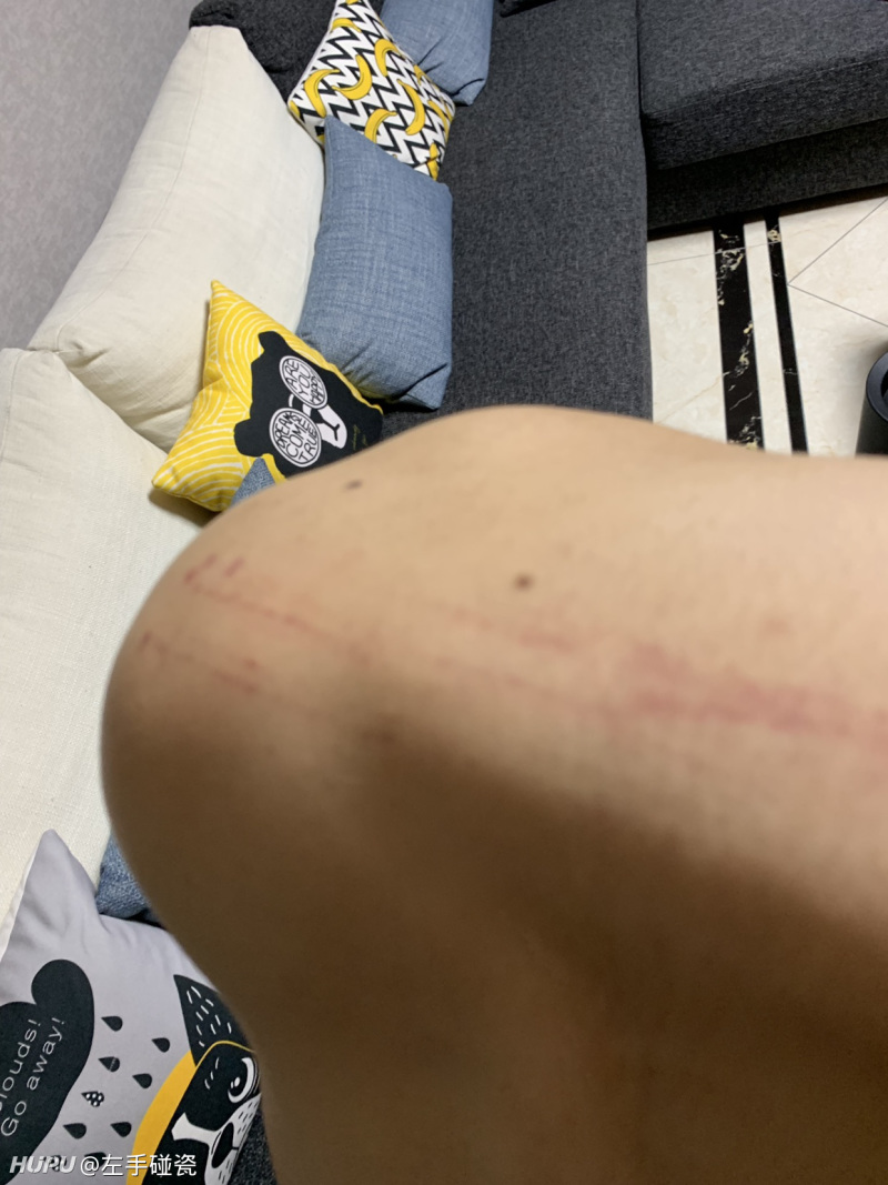 不懂就问,练完腿肩膀上有血痕