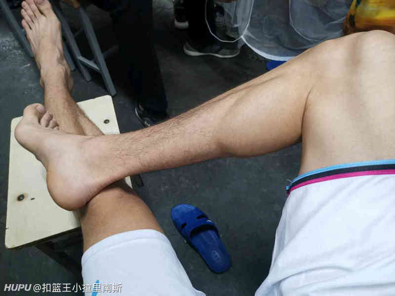 听说最近流行嗮跟腱?